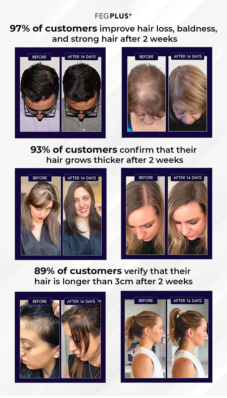 FEG PLUS Hair Growth SERUM